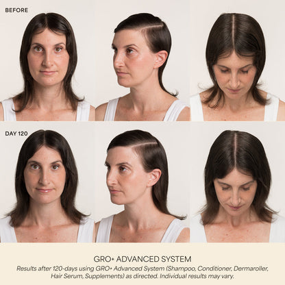 GRO+ Advanced Hair Serum