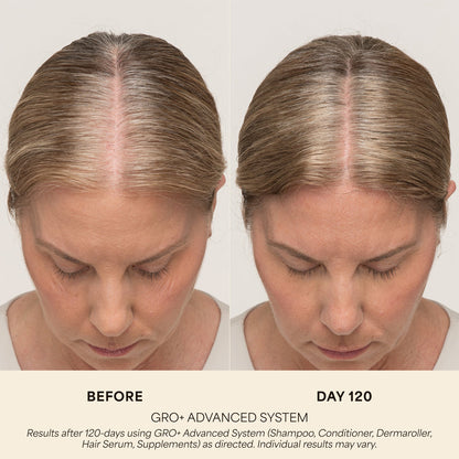 GRO+ Advanced Hair Serum